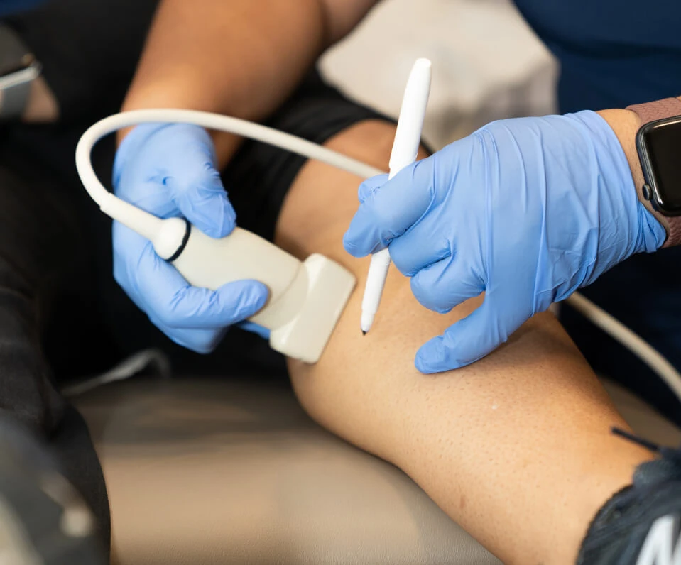 Vein treatment procedure